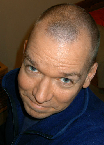 Hair trimmer accident, early 2009